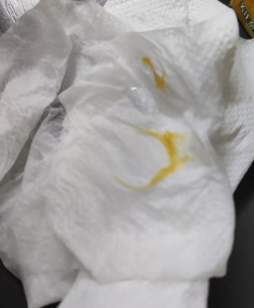 奈雪富柚汁惊现异物，官方回应避重就轻，问题究竟出在哪？